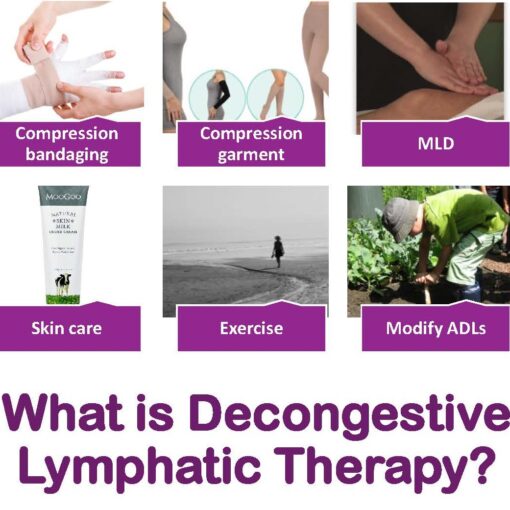 What is decongestive lymphatic therapy (DLT)