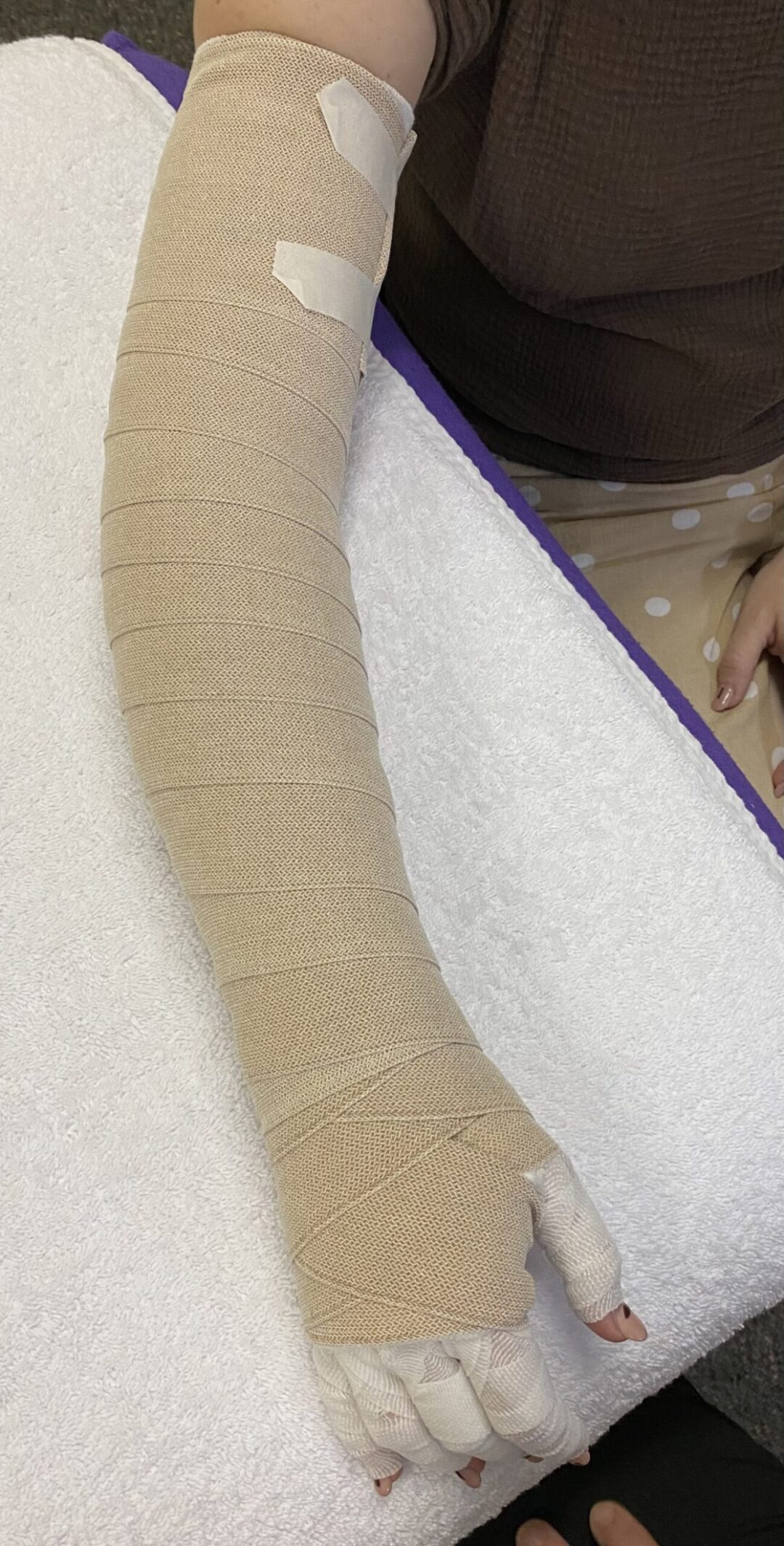 Bandaging Your Arm A Step By Step Guide Lymphoedema Therapy Training And Education